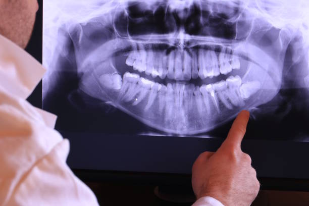 Best After-Hours Emergency Dentist in Center Point, IA