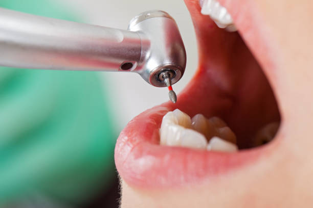 Best Emergency Tooth Extraction in Center Point, IA